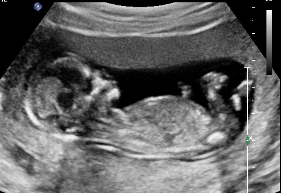 echo van baby